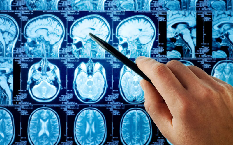 arcadia-neurologia-neurochirurgia-fano arcadia-neurologia-neurochirurgia-fano